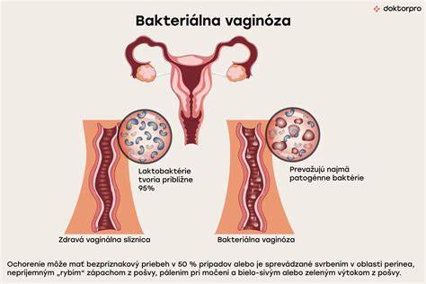 Príznaky bakteriálnej vaginózy a vaginálna mikroflóra