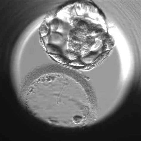 Laboratórny výber embrya pri IVF