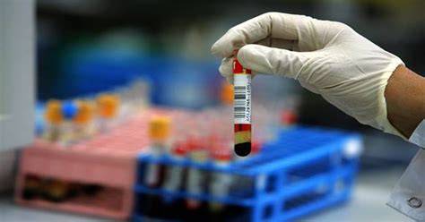 Laboratórne vyšetrenie spermiogramu