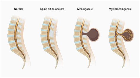 Spina bifida a tehotenstvo, anatómia chrbtice