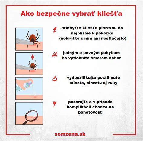 Postup odstránenia kliešťa pinzetou