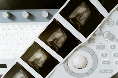 Ultrazvuk zamlknutého tehotenstva