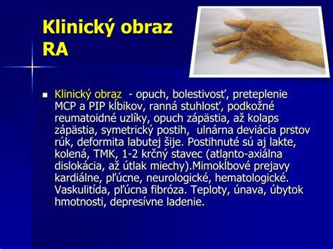 Opuch zápästia a stlačenie nervu