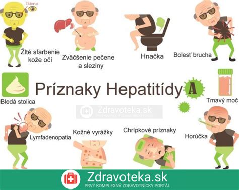 Prenos hepatitídy A kontaminovaným jedlom