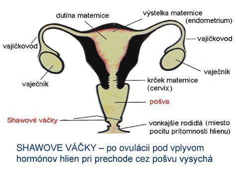 Vznik litopédionu pri mimomaternicovom tehotenstve
