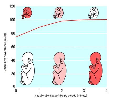 odber pupočníkovej krvi placenta