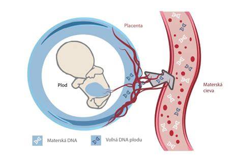 Fragmenty fetálnej DNA v krvi matky